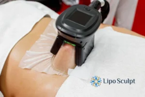 Cryolipolysis Helping You Getting that Perfect Summer Body 3 Cryolipolysis Buckhurst Hill can give you the best summer body - contact us today!