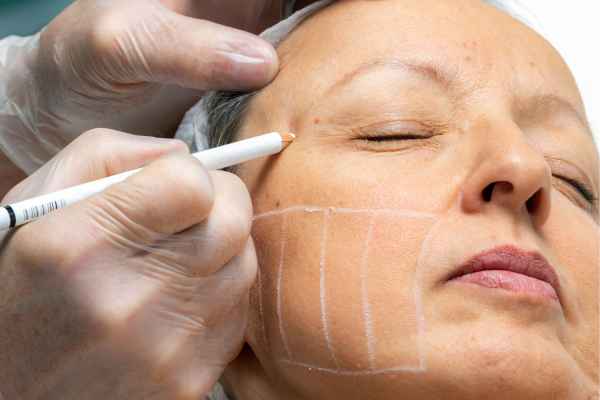 CryoPen: 5 Skin Concerns It May Be Used to Treat 4 What should you ask before having CryoPen treatment Buckhurst Hill?