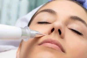 Best Actinic Keratoses Removal 3 Actinic keratoses Buckhurst Hill solutions - book in today!