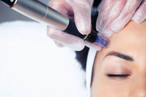 Explaining Total Skin Tightening Treatment and What to Expect 2 What Skin Concerns Can Total Skin Tightening Treatment Help With Buckhurst Hill?